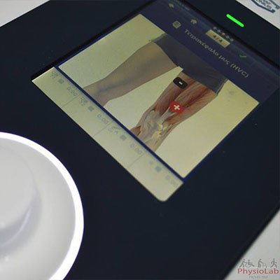 Electrotherapy treatment session at PhysioLab